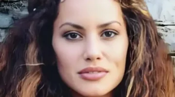 صدمة تركية.. فنانة تنشر صور اعتداء زوجها عليها